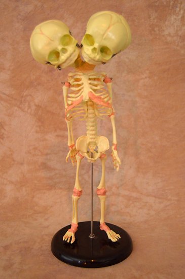 Real Human Fetal Skeleton On Stand